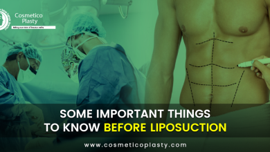 Liposuction in Lahore