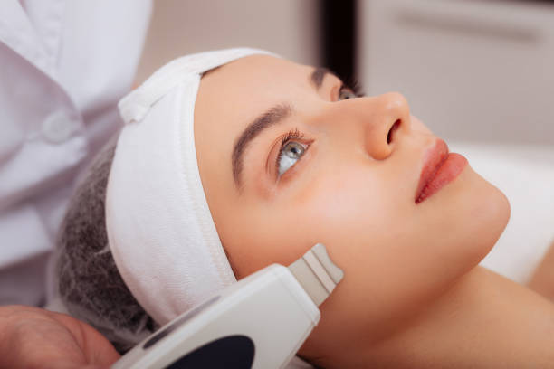 acne scar treatment Singapore