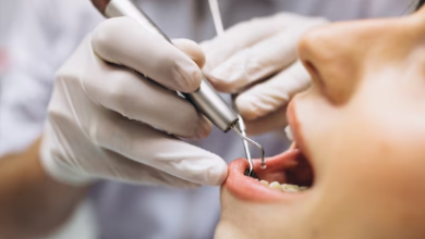 emergency dentist Brampton