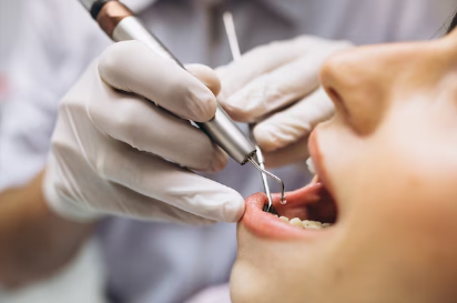 emergency dentist Brampton