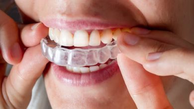 Invisalign Treatment Aberdeen