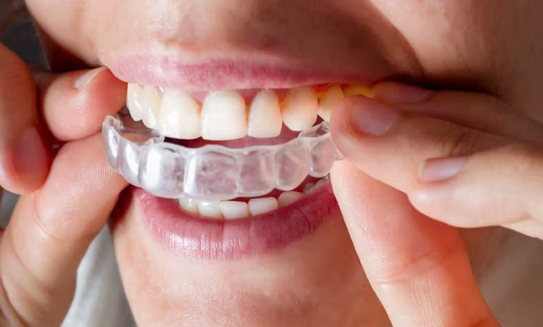 Invisalign Treatment Aberdeen