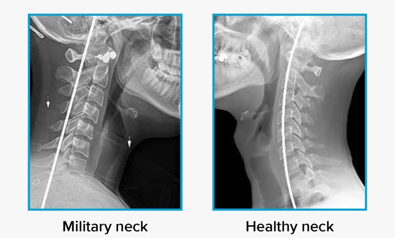 Military Neck