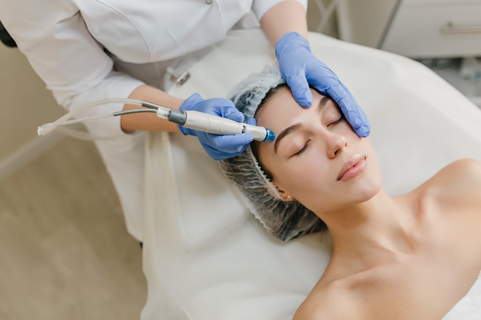 Microneedling Facial